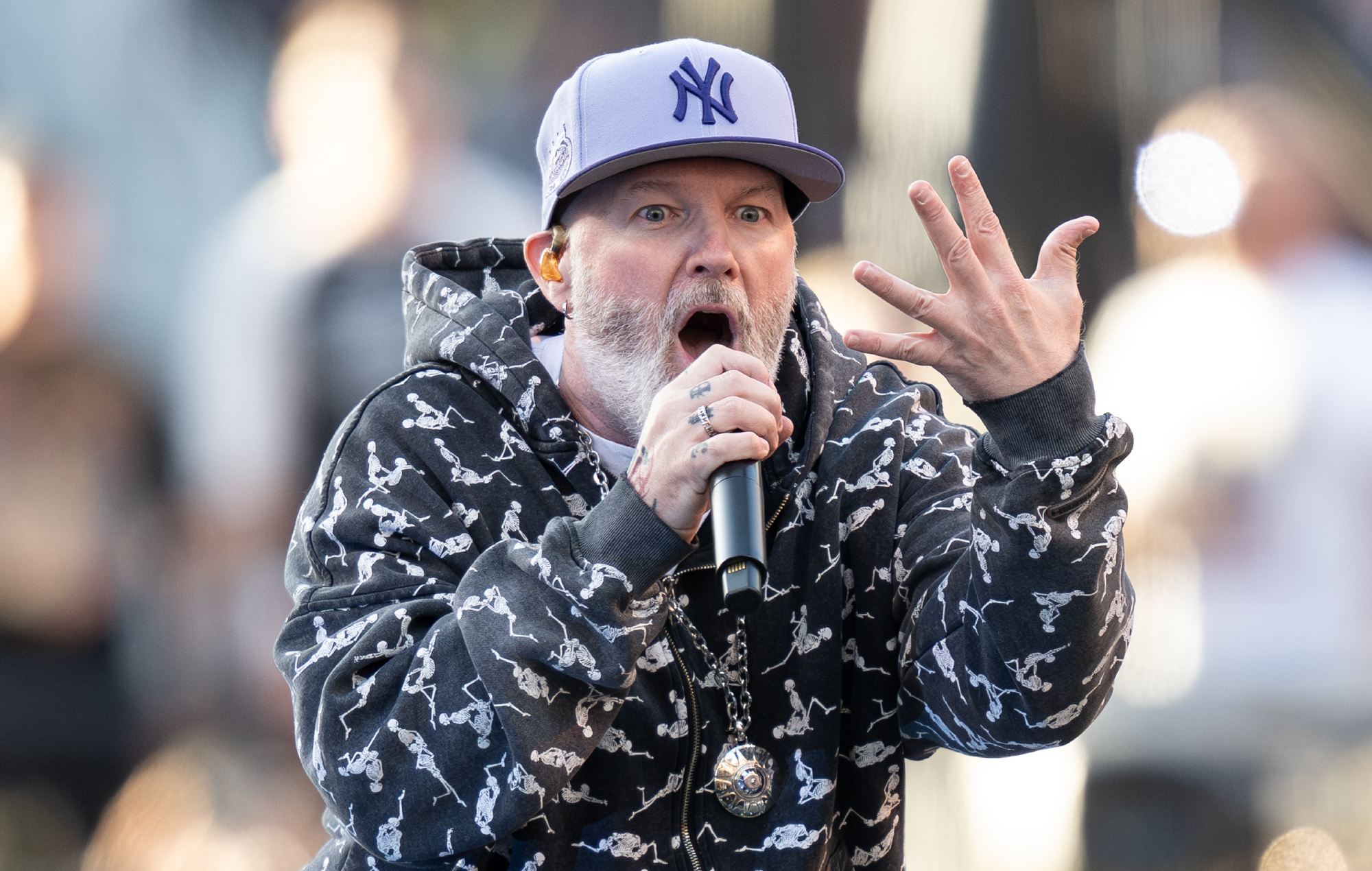 Fred Durst